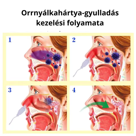 Fényterápiás készülék orrdugulás, nátha, allergia kezelésére